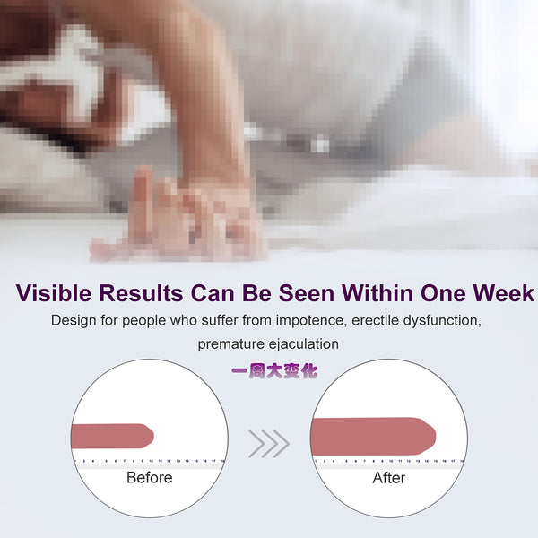 Male penis hook stretching traction device bracket extension correction physical training system